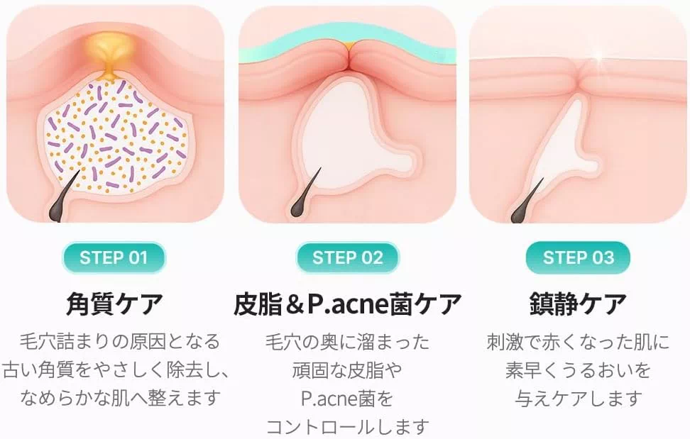 아젤라익산 16% 메디큐브 세럼 30ml 모공 트러블 케어 상세설명 포스트